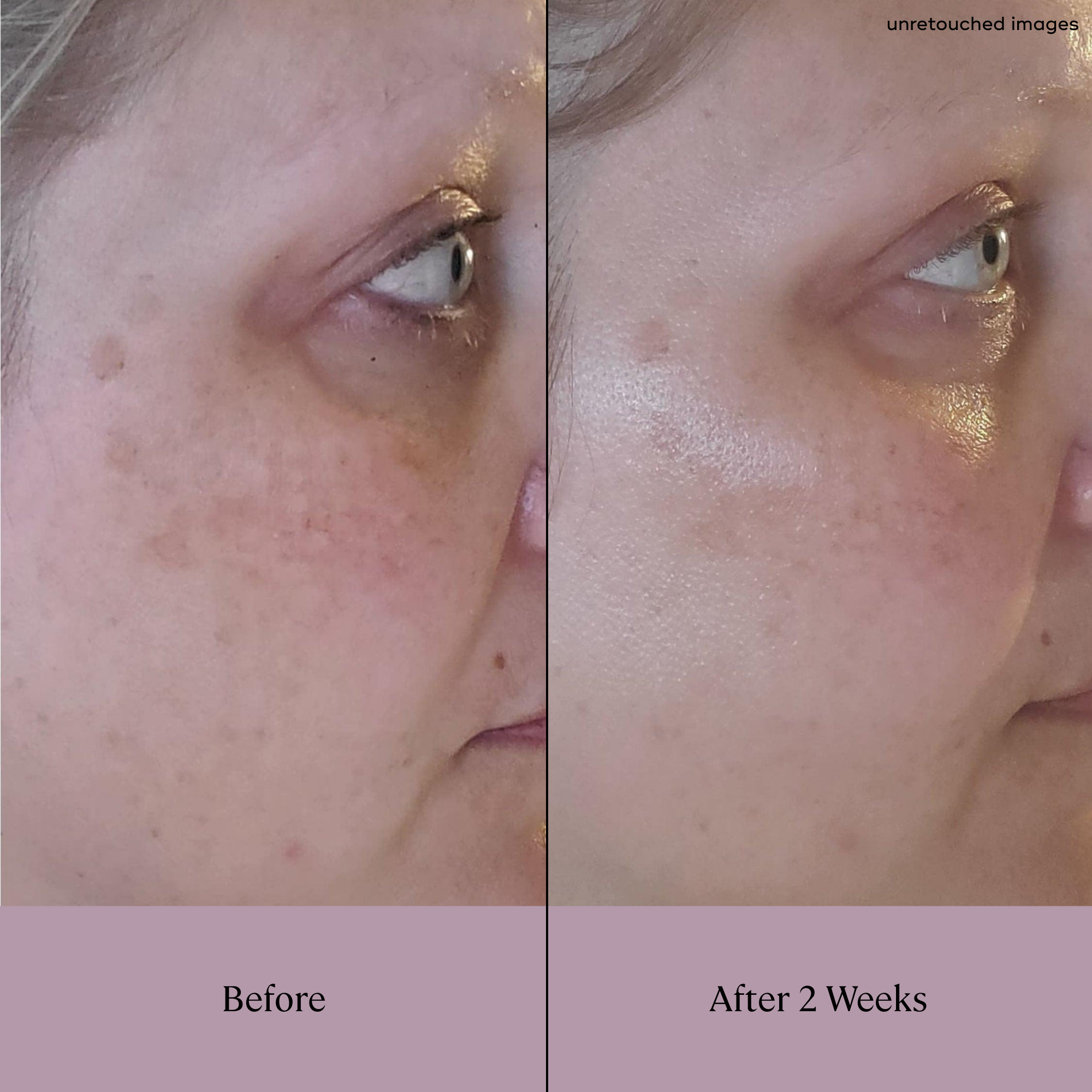 Before and After Result (2 Weeks)