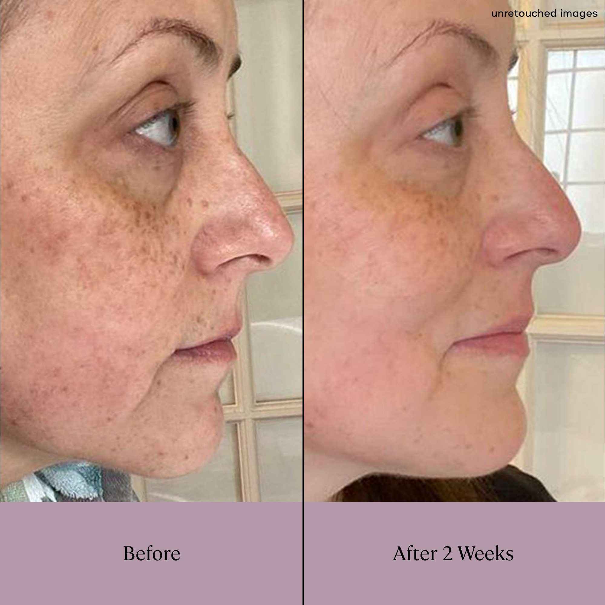 Daily At Home Facial