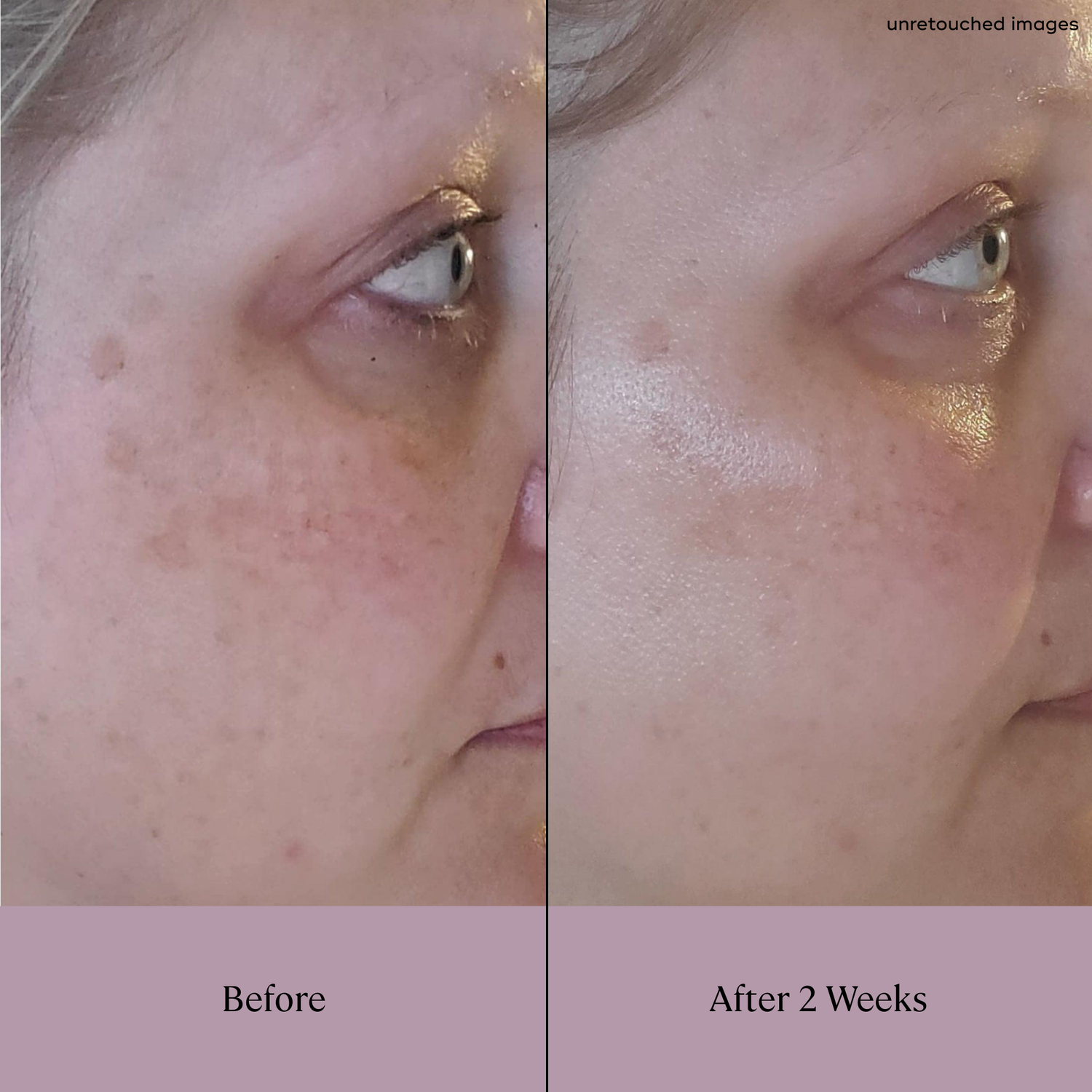 DAYTIME Brightening Serum