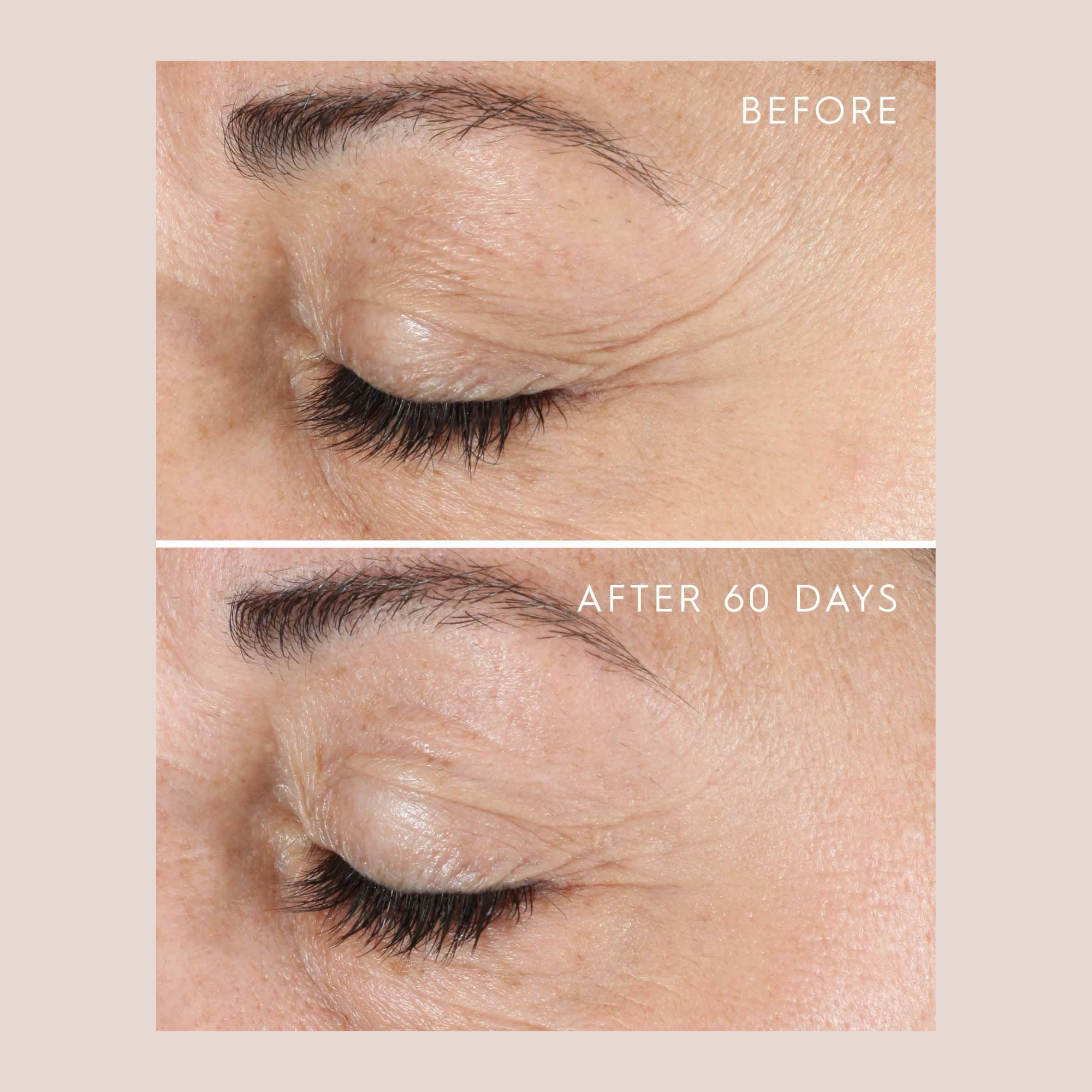 YOUTHFUL Essential Eye Concentrate