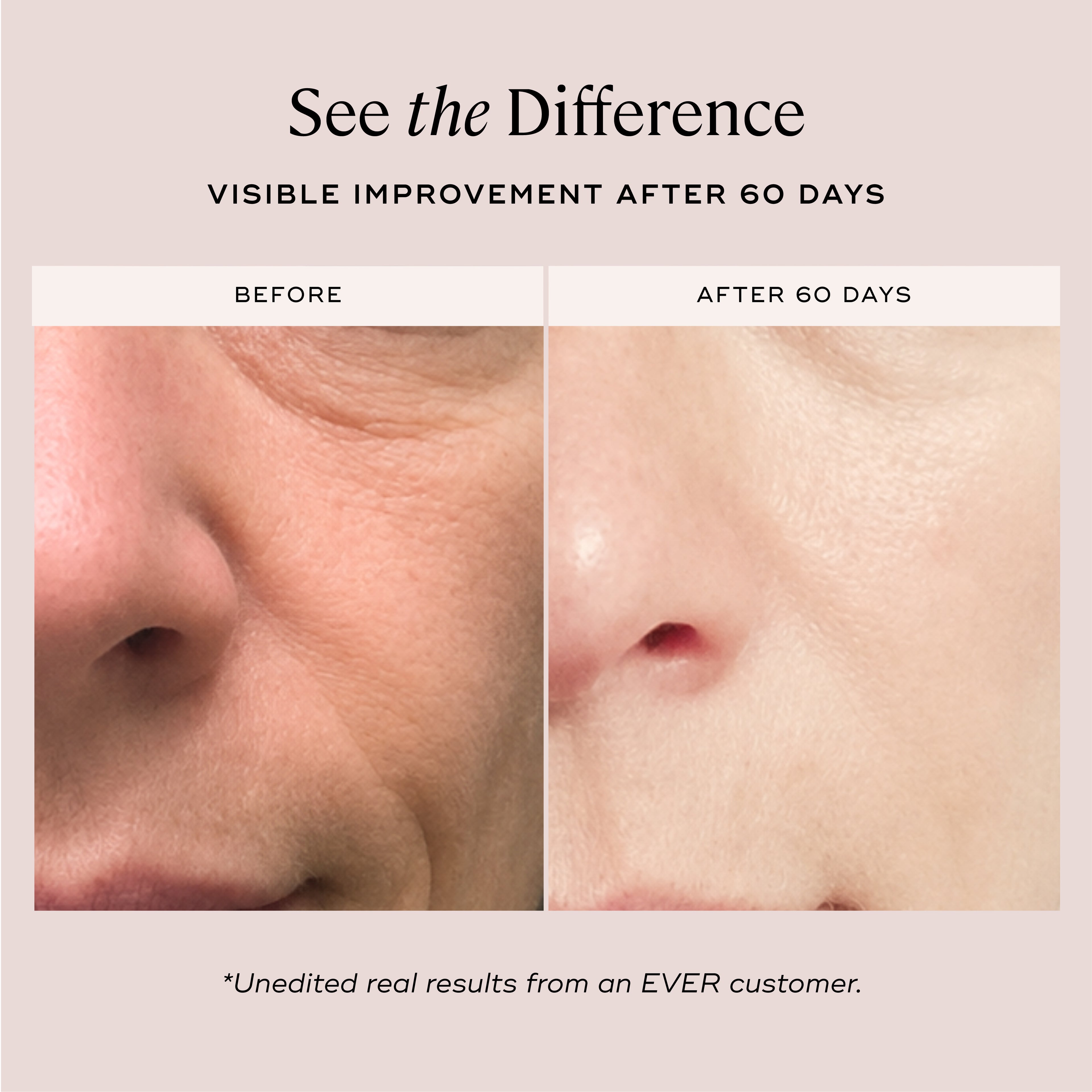 EVER Skincare Serum 1 oz YOUTHFUL Quattro Peptide Face & Eye Serum