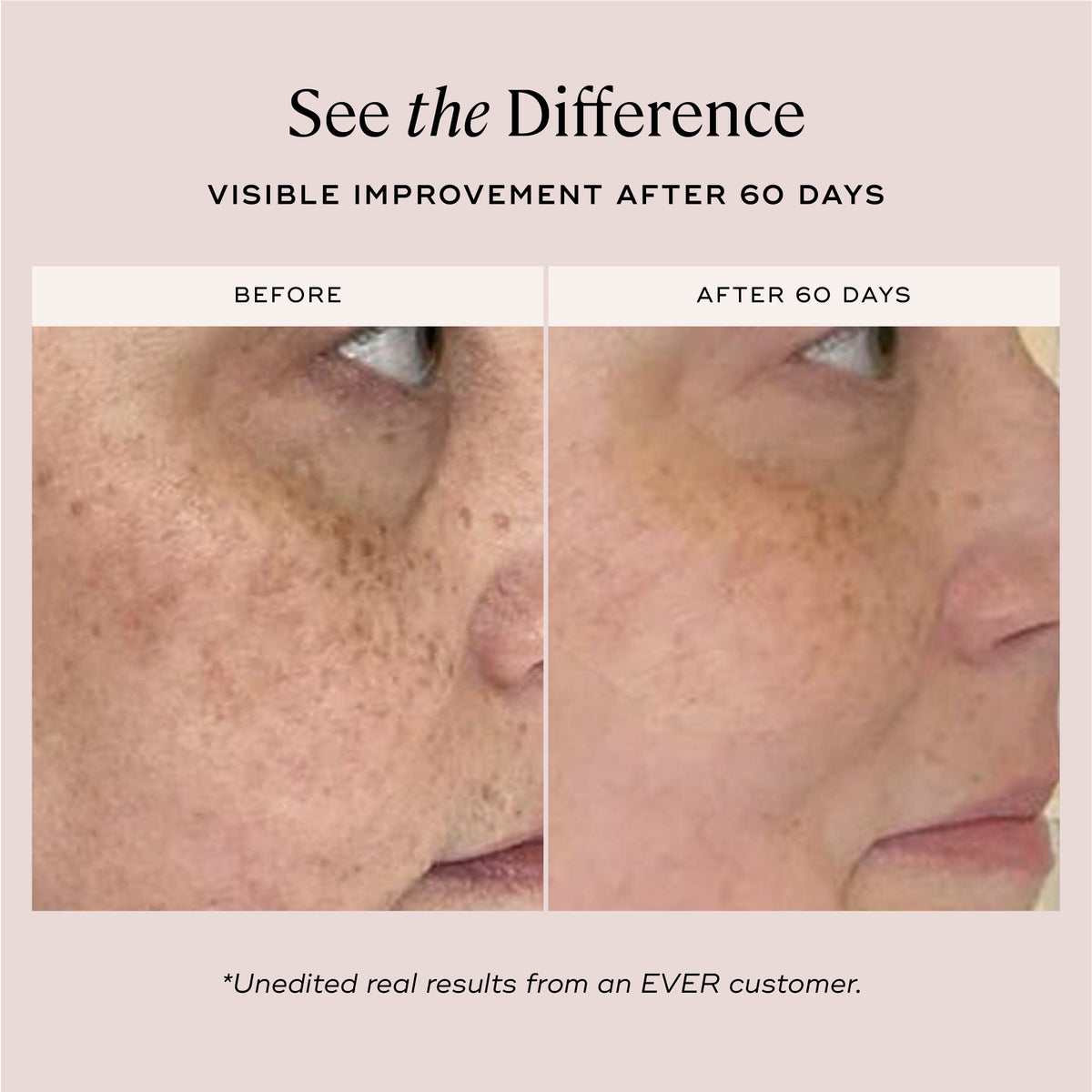 EVER Skincare Serum DAYTIME Brightening Serum
