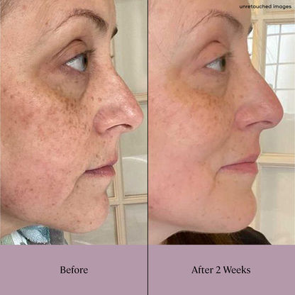 Daily At Home Facial