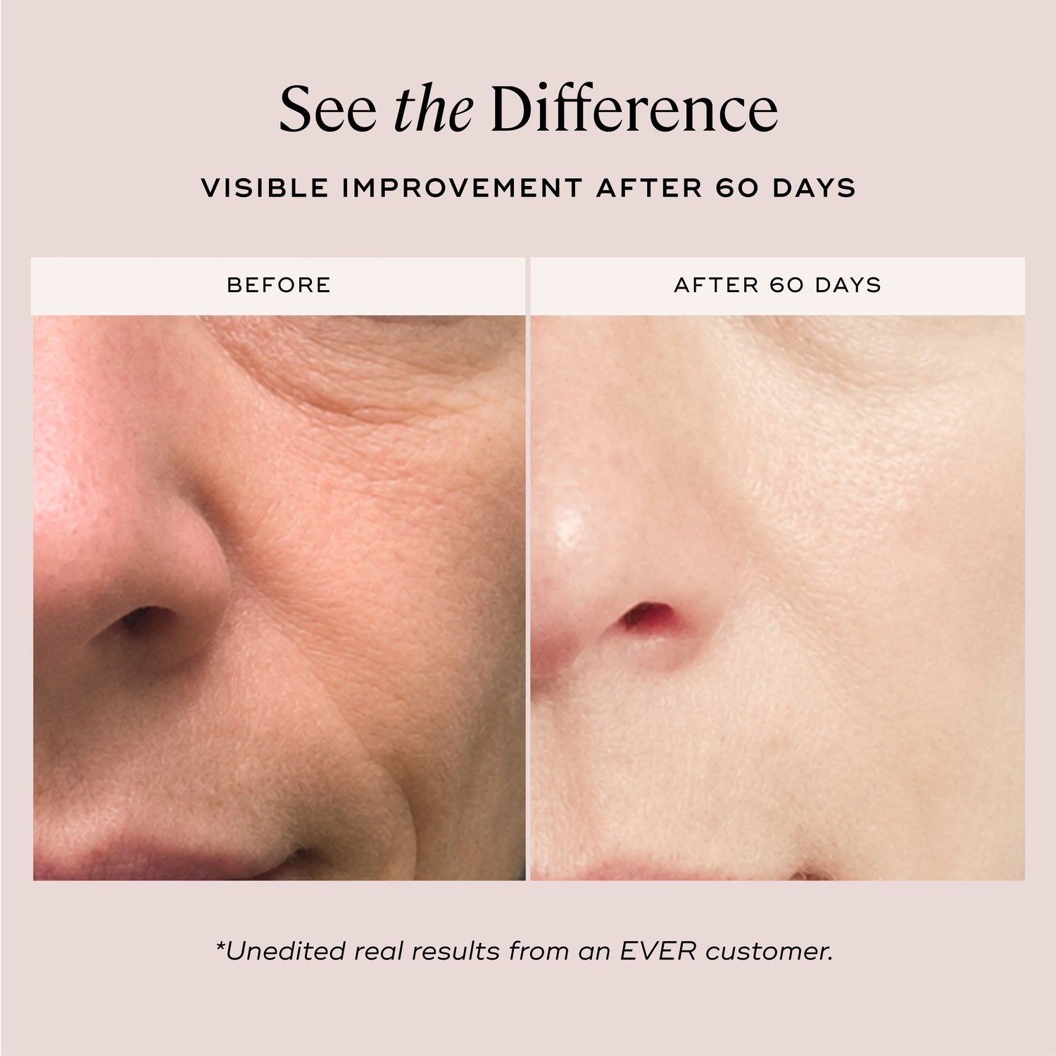 EVER Skincare Serum 1 oz YOUTHFUL Quattro Peptide Face &amp; Eye Serum