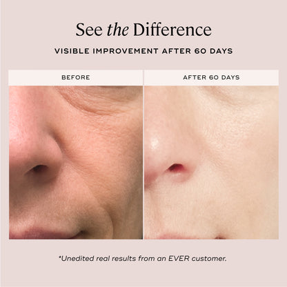 EVER Skincare Serum 1 oz YOUTHFUL Quattro Peptide Face &amp; Eye Serum