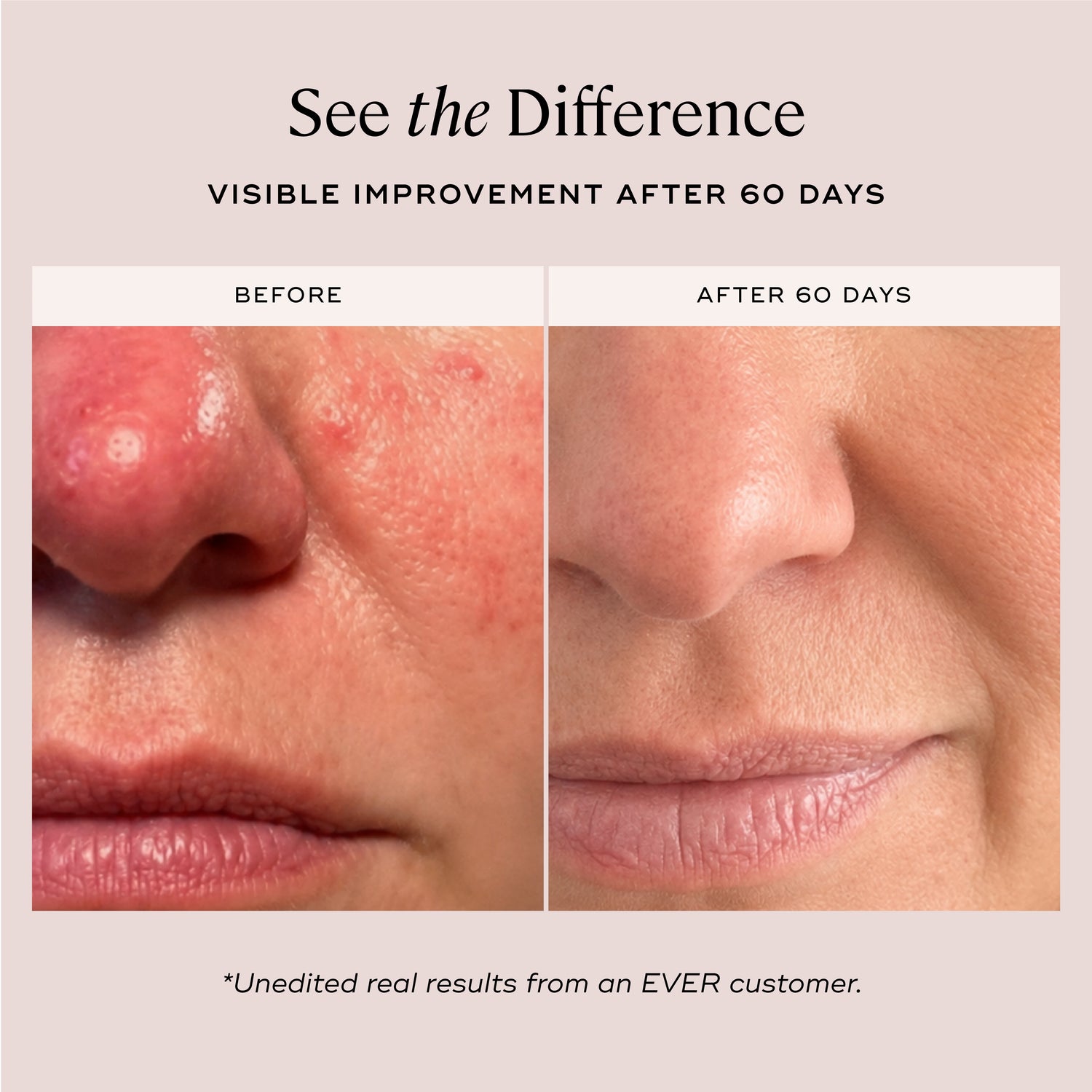 EVER Skincare Serum OVERNIGHT FACIAL Cellular Renewal Oil
