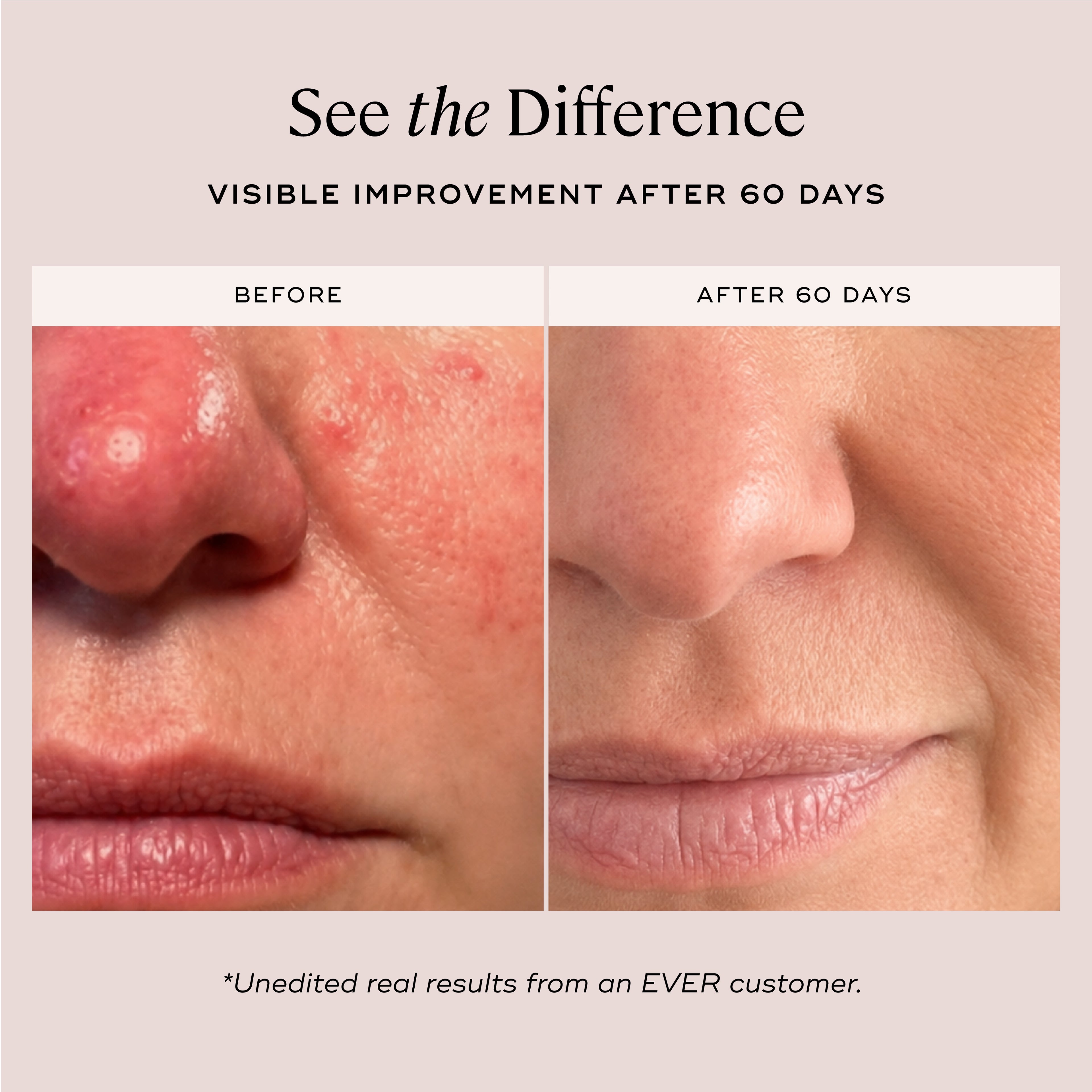 EVER Skincare Serum OVERNIGHT FACIAL Cellular Renewal Oil