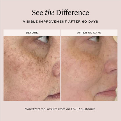 EVER Skincare Serum DAYTIME Brightening Serum