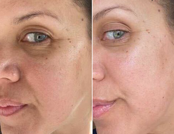 Lisa has been using Daytime Brightening Serum for 10 days.  Her results include brighter skin, less discoloration and spots, and hydrated glowing skin!